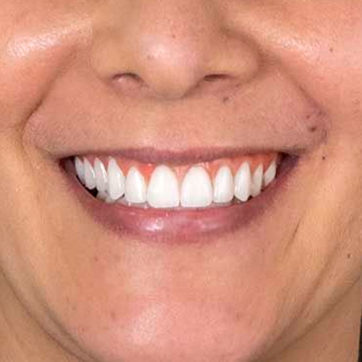 Maximarques Odontologia | Implantes e Dentista em Gaspar 22.