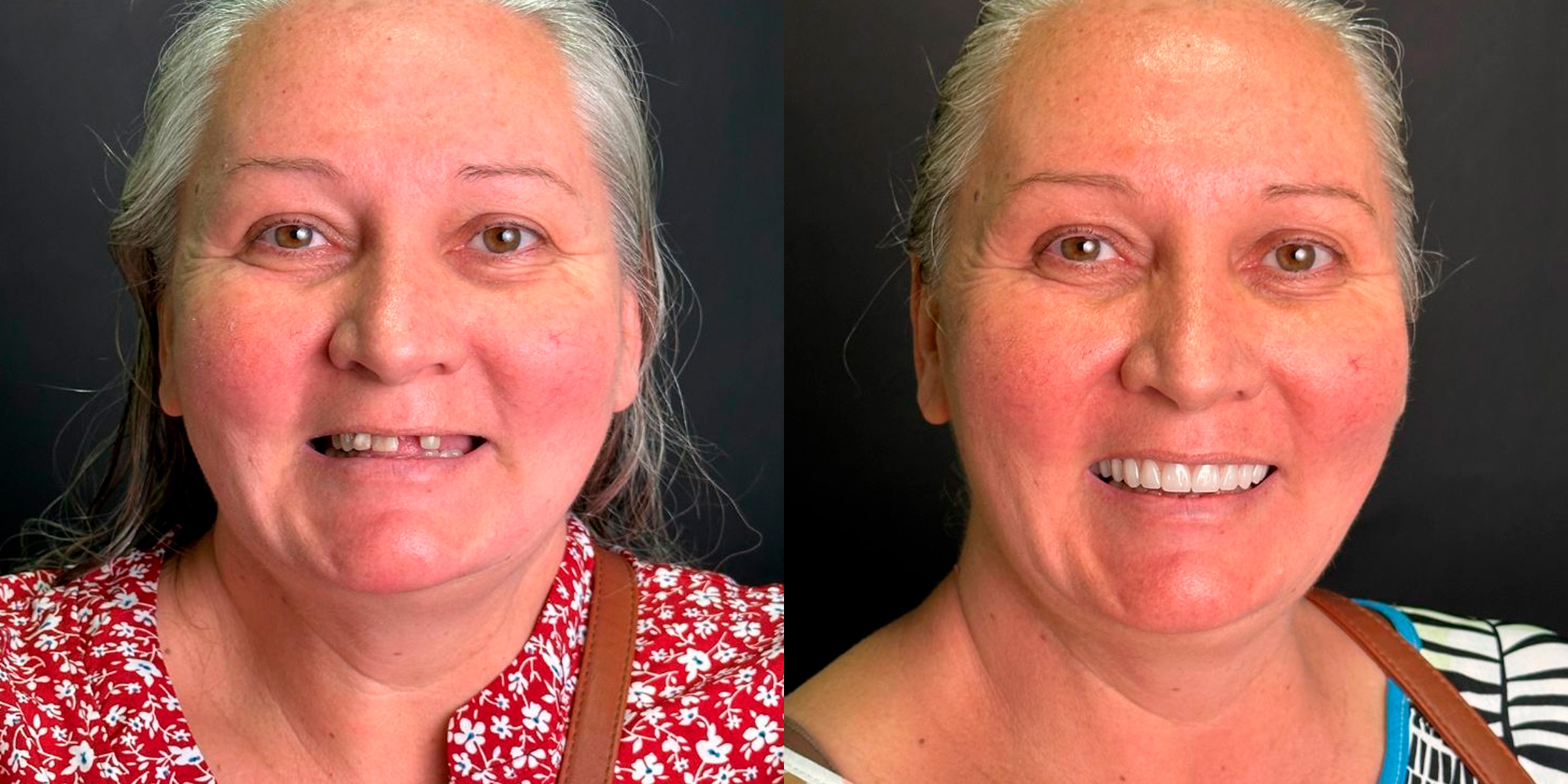 Maximarques Odontologia | Implantes e Dentista em Gaspar 16.