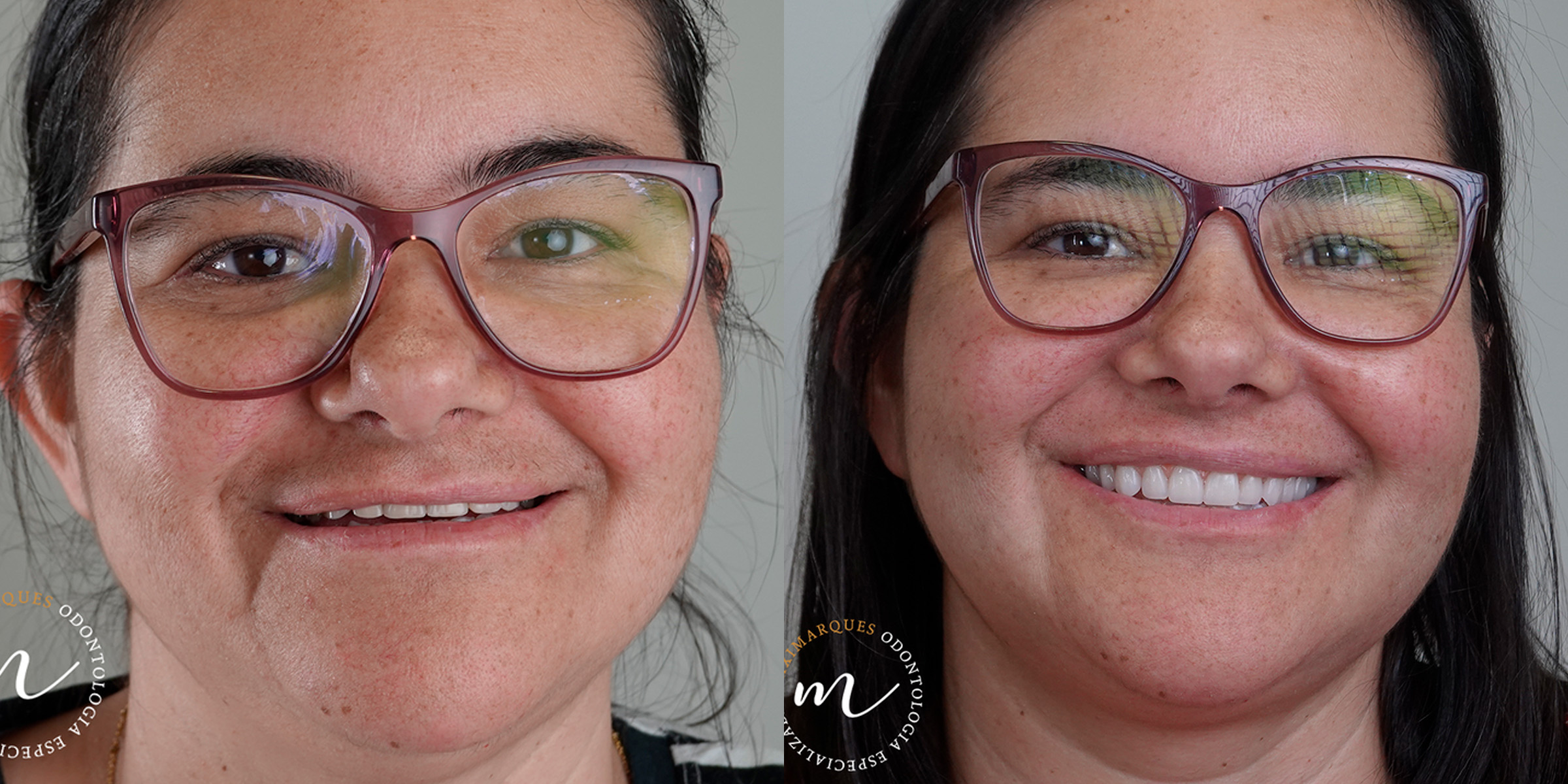 Maximarques Odontologia | Implantes e Dentista em Gaspar 20.