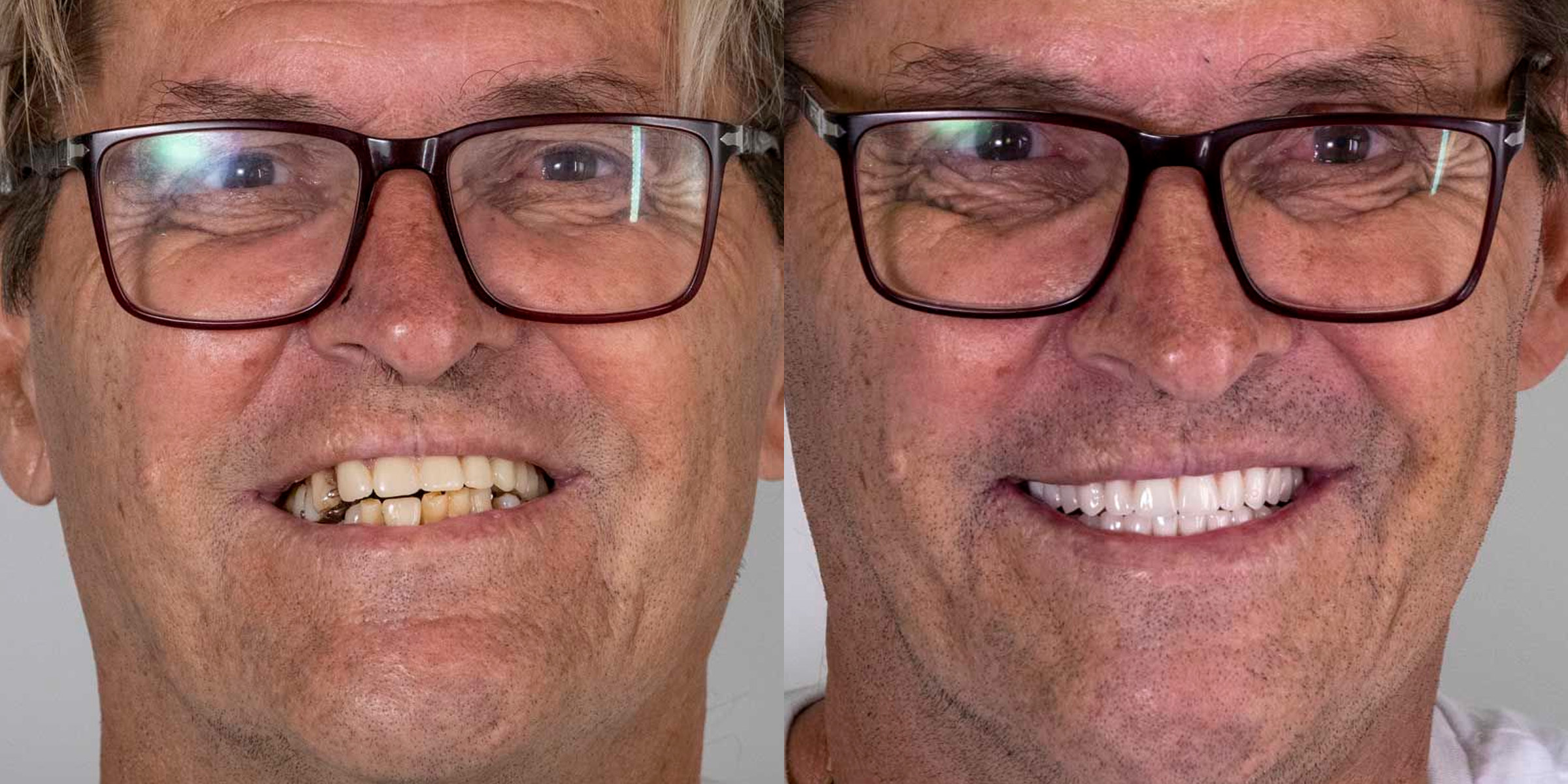 Maximarques Odontologia | Implantes e Dentista em Gaspar 14.