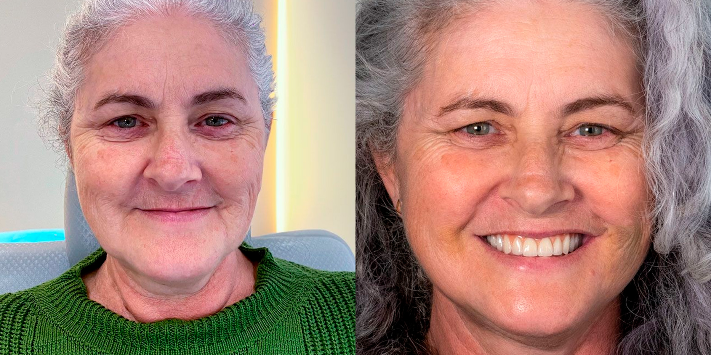 Maximarques Odontologia | Implantes e Dentista em Gaspar 15.