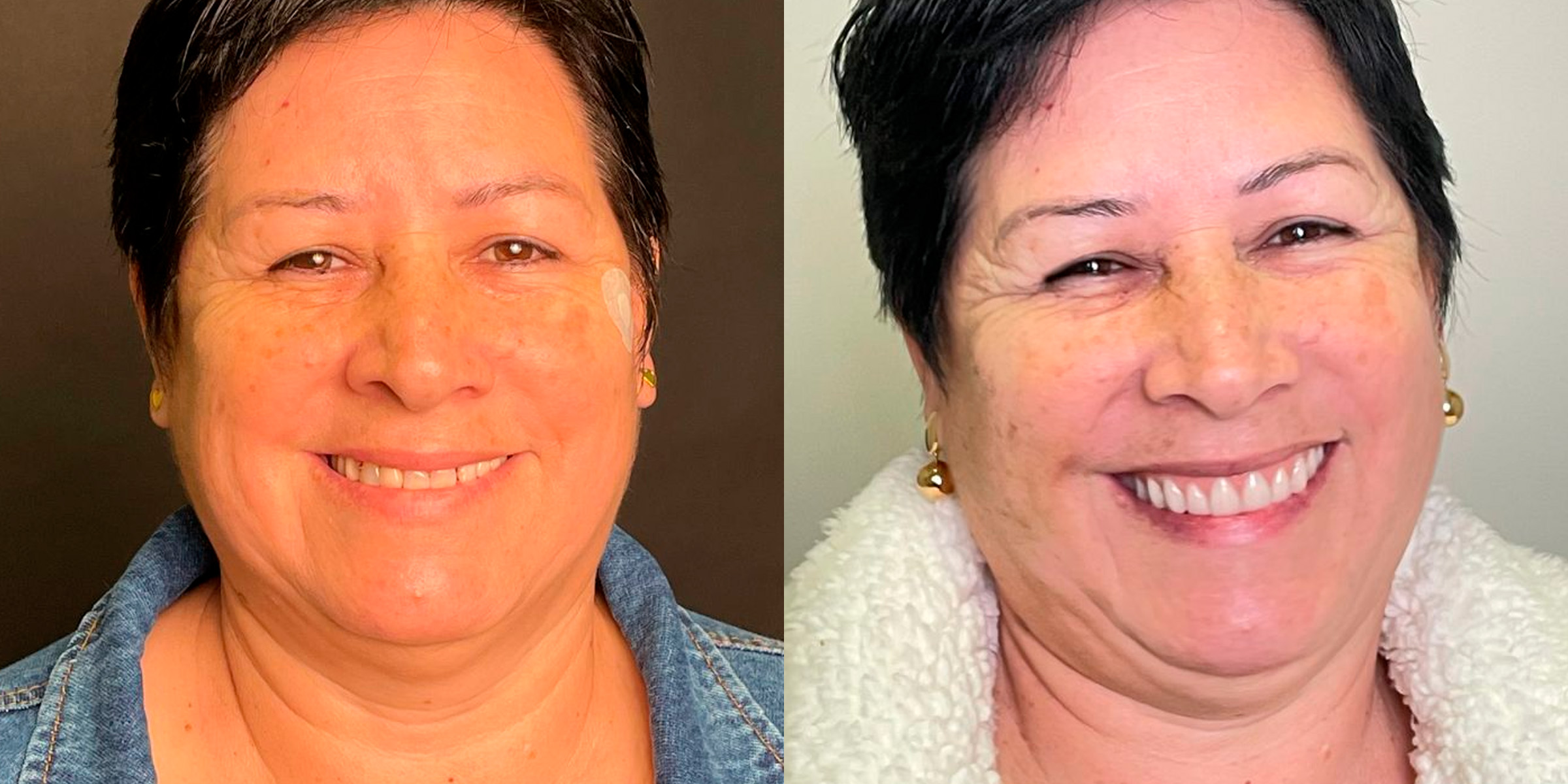 Maximarques Odontologia | Implantes e Dentista em Gaspar 11.