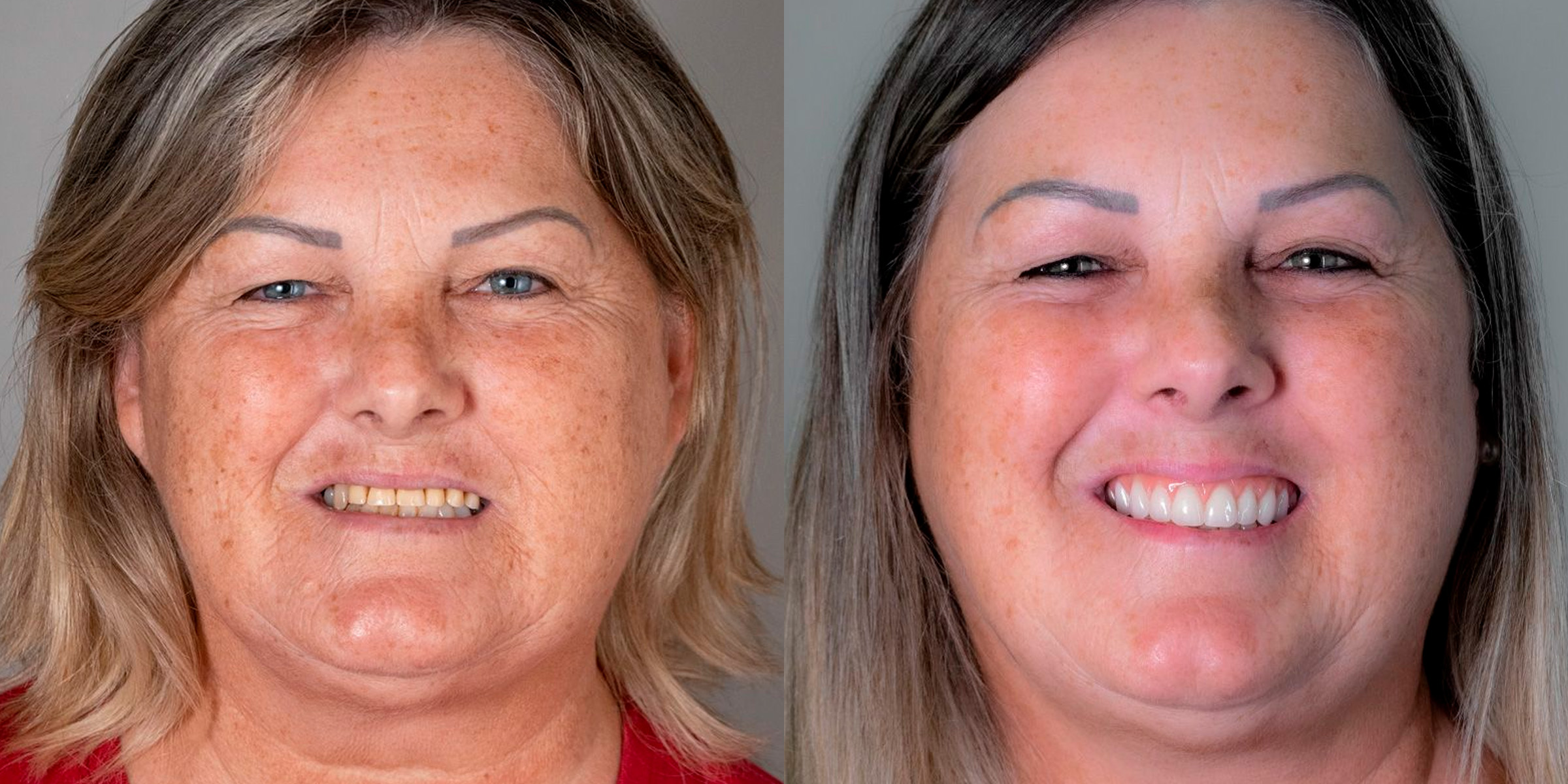 Maximarques Odontologia | Implantes e Dentista em Gaspar 10.