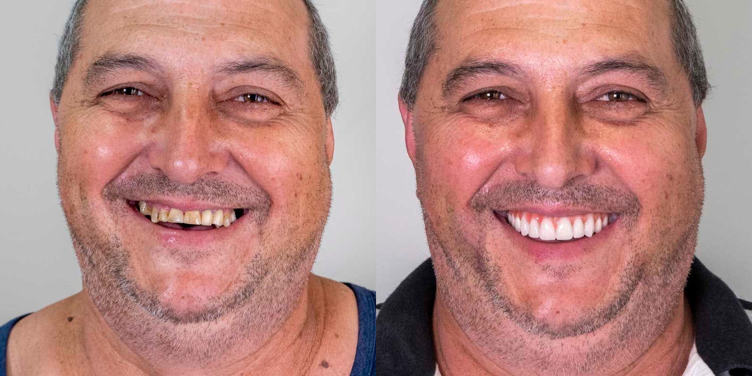 Maximarques Odontologia | Implantes e Dentista em Gaspar 19.