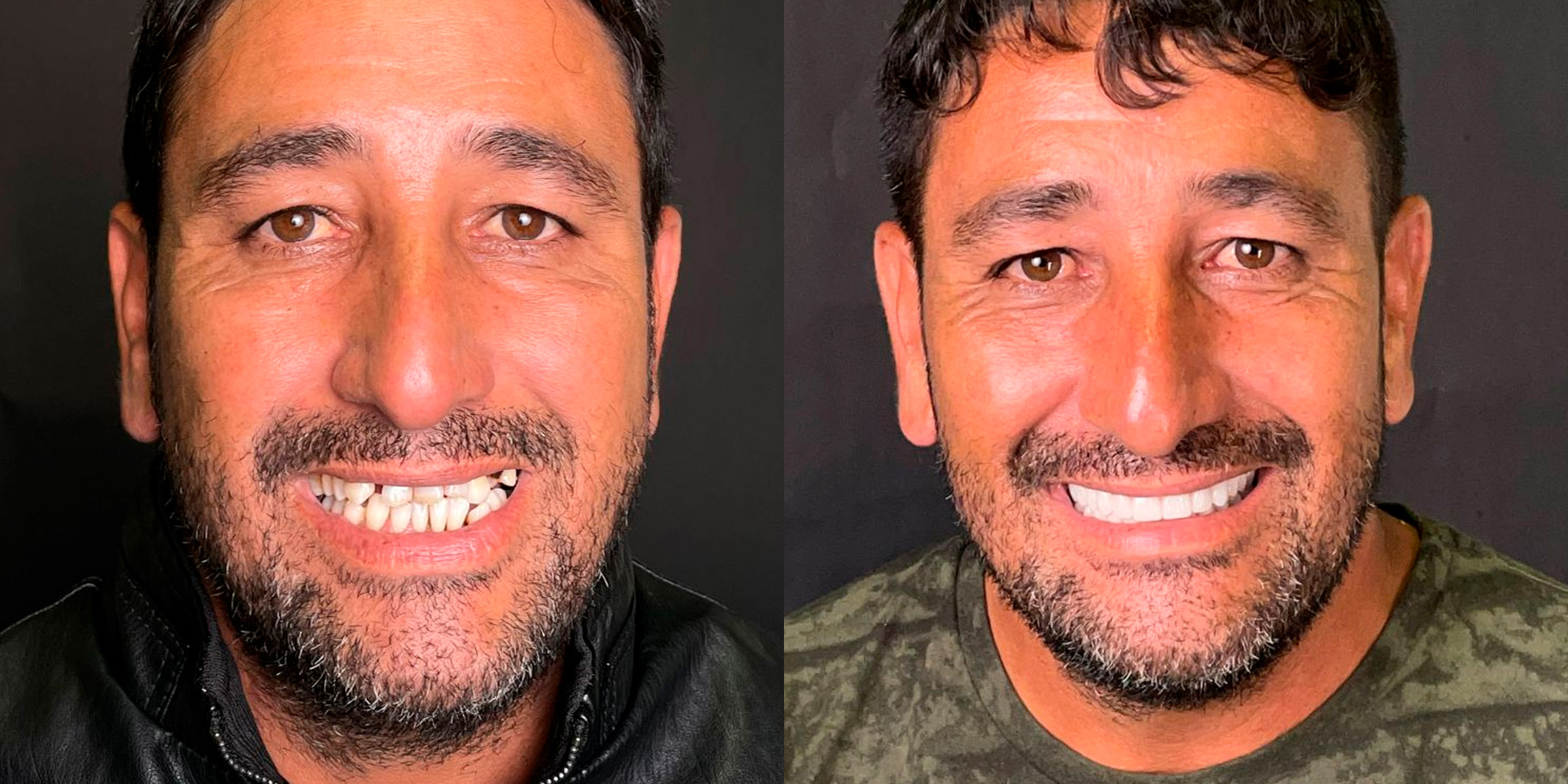 Maximarques Odontologia | Implantes e Dentista em Gaspar 21.