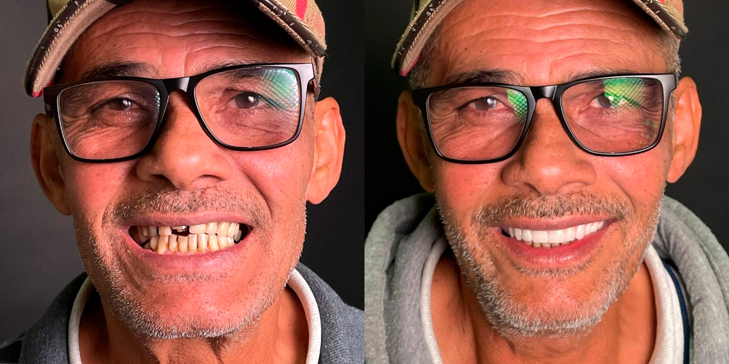 Maximarques Odontologia | Implantes e Dentista em Gaspar 18.